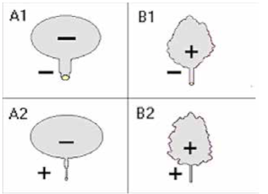 Tipos de Vejiga Neurogénica A1, B1, A2, B2